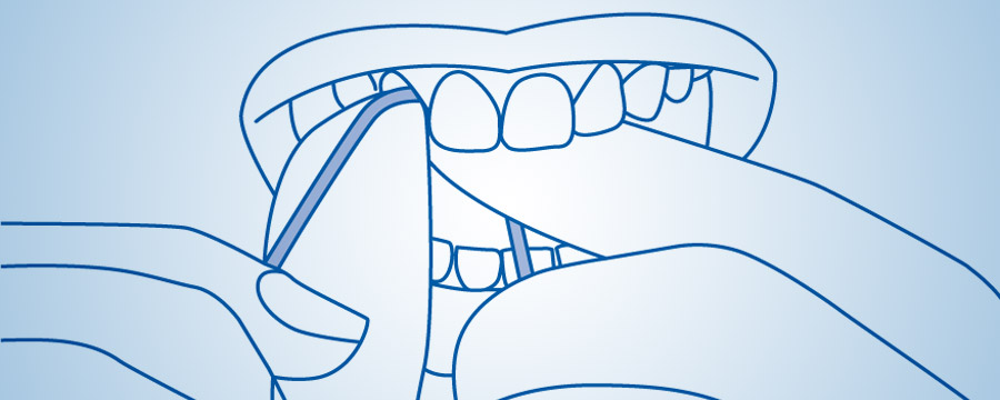 Как правильно использовать зубную нить