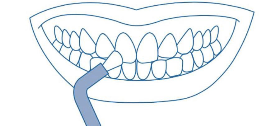 Гигиена зубов зубной щеткой CS single. Техника Соло