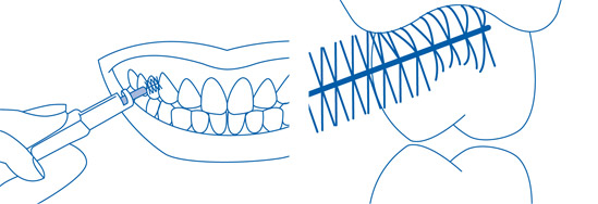 Interdentalbürsten richtig anwenden - 