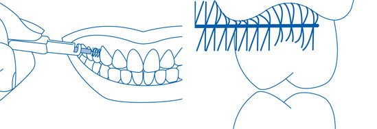 Interdentalbürsten richtig anwenden - 